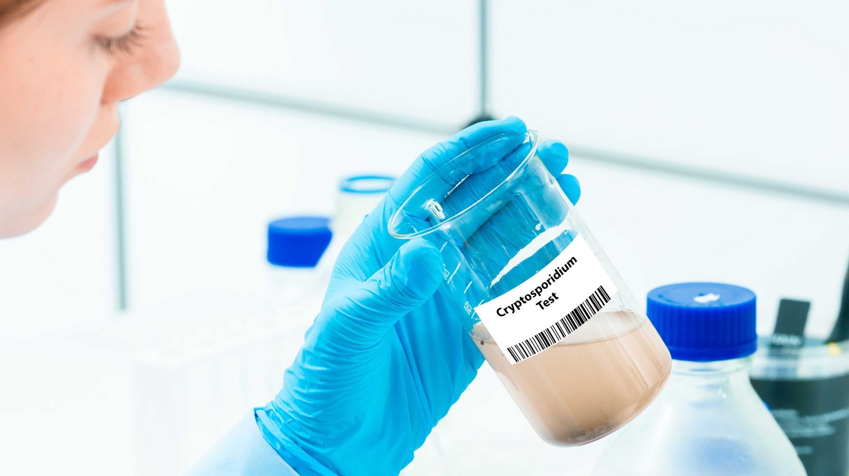 Infection des réseaux au Cryptosporidium : quelles mesures face au parasite ?